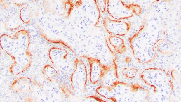 placental cells from a stillbirth with SARS-CoV-2 infection